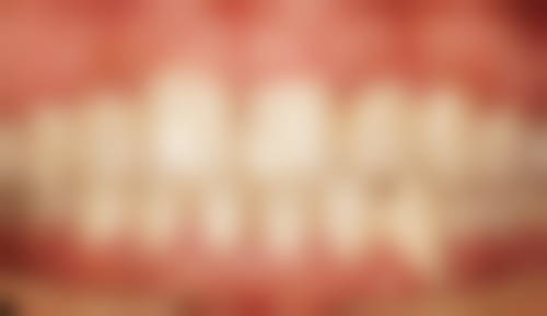 抚顺兰海口腔门诊部给小孩子拔牙值不值？