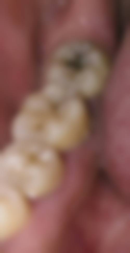 福州美蒂斯口腔口碑怎么样：患者的真实评价