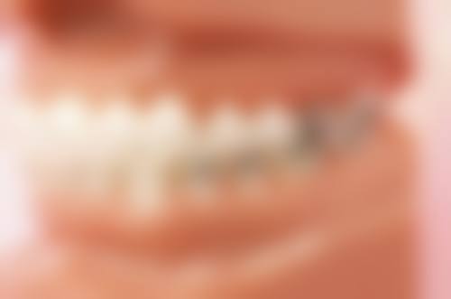 补牙杀神经和直接补牙哪个更适合我?