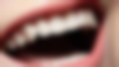 博爱口腔（顺义双兴店）真实实例：眼见为实的改变