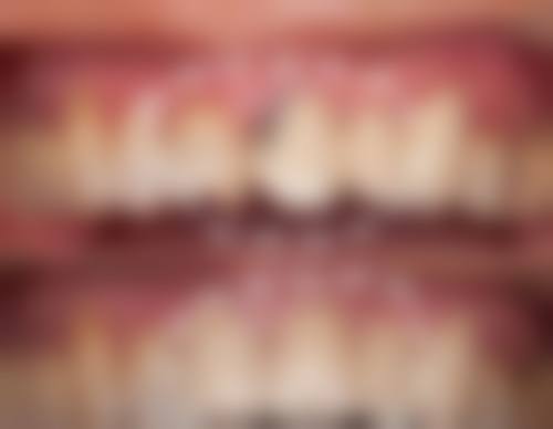 江苏徐州沛县王灿口腔预约挂号方式