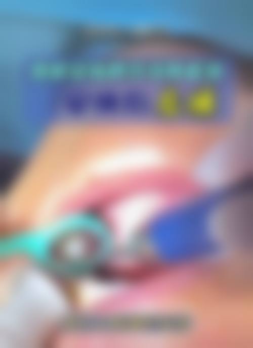 怀集县口腔医院预约挂号方式