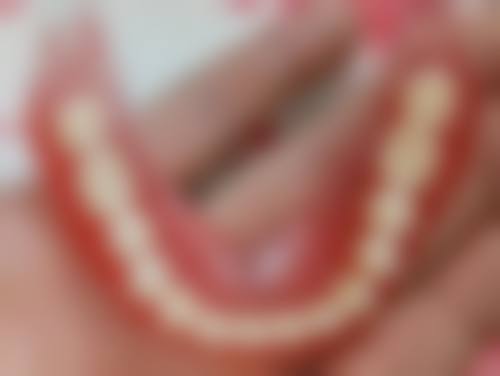 王元琴医生的技术特点