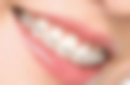 北京贝齿佳口腔门诊部的烤瓷牙冠和全瓷牙冠哪个更适合我?