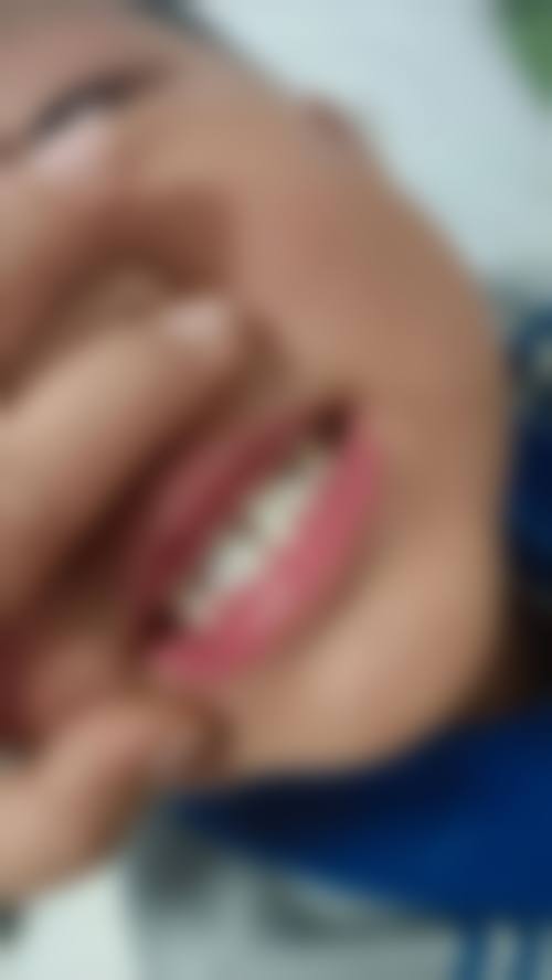 温州医 科 大学附属口腔医院儿童口腔科价格表