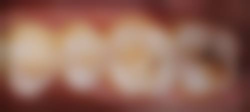 广东深圳丽雅口腔门诊部医生名单：专精团队为你护航