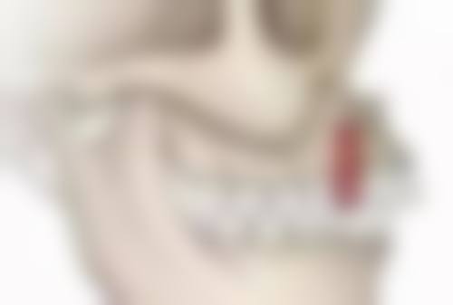 根管治疗末尾一次推迟多久才需要重新治疗？