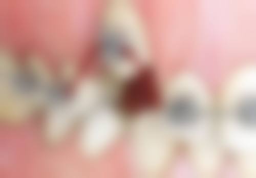 江苏淮安明鹏口腔电话号码：一键开启就诊之旅