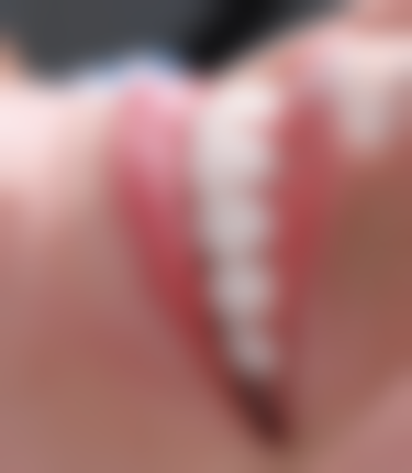 江苏淮安明鹏口腔执业信息：正规可靠有保护