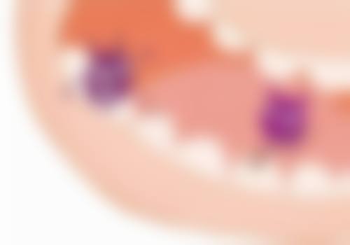 箍牙拔4颗牙在北京禾美嘉医疗美容靠谱吗？