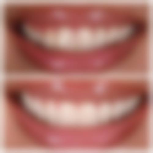 兴县舒客口腔诊所预约挂号方式:轻松便捷开启看牙之旅