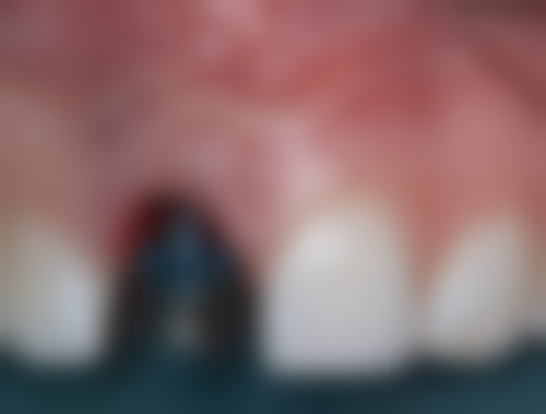 烟台德韩百仕口腔门诊部预约挂号方式