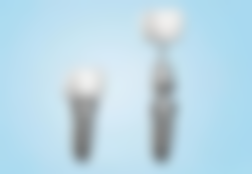 苏冬云医生坐诊医院：西安瑞泰口腔医院的优势