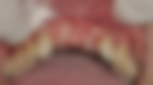 江西 南昌牙洁仕口腔预约挂号方式