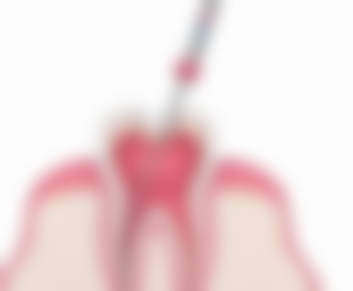 宝宝吸嘴唇得地包天的几率怎么样