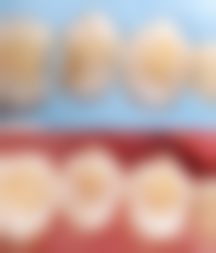 山东烟台荣贤齿科电话号码：一键开启口腔健康之旅