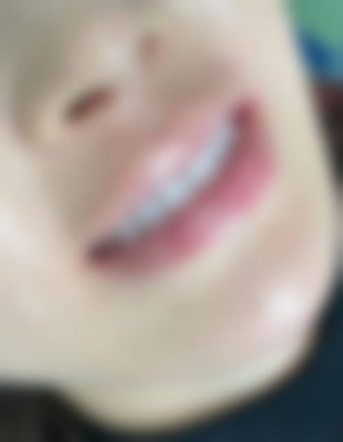 上海科瓦口腔门诊部（金茂大厦店）价格表：超值服务性价比高