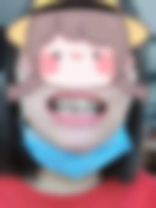 宁波康贝口腔诊所真实实例