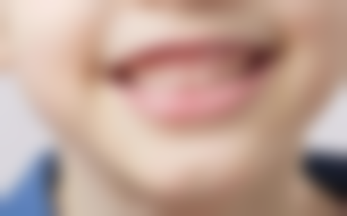 北京画美医疗美容应对洗牙后一年多牙酸靠谱吗