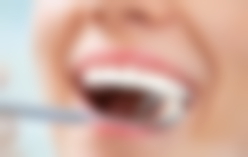 超声波洗牙后要注意什么？北京圣嘉新医疗美容医院口腔科