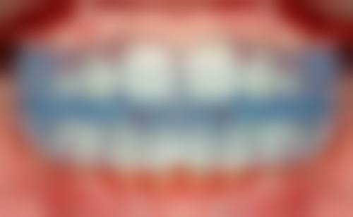 江苏南京木子严口腔擅长项目