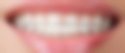 50岁在福清东南眼科医院种植牙靠谱吗？