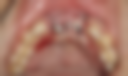 重庆牙博仕口腔门诊部价格表：透明合理有优惠