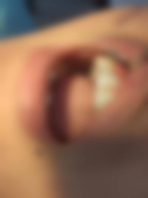 镇江扬中精诚口腔门诊部真实实例