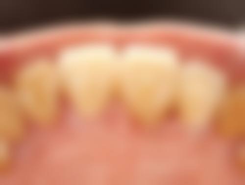 重庆牙博仕口腔门诊部预约挂号方式：便捷效率高不等待