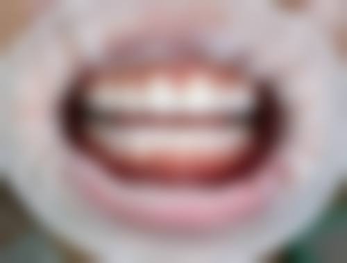 徐州市全成博康口腔连锁医生名单：专精团队为你护航