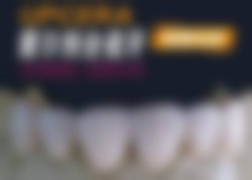 美国3M Lava烤瓷牙靠谱吗