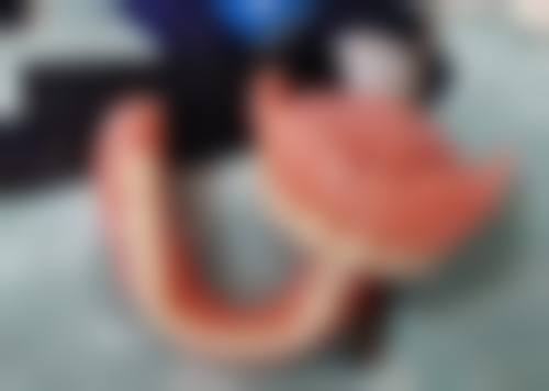 北京顺安圣光口腔门诊部做过化疗拔牙靠谱吗？