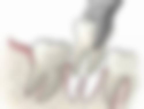 上海维佳康口腔（徐汇新隆机构）真实实例