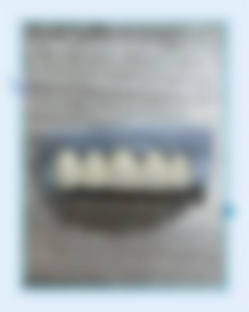 南宁诺贝尔口腔真实实例：见证神奇成效