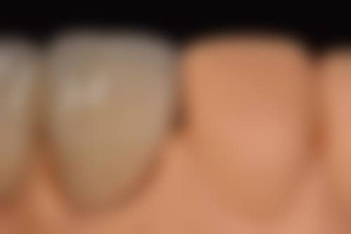 深圳皓齿美口腔诊所电话号码：随时沟通解疑惑