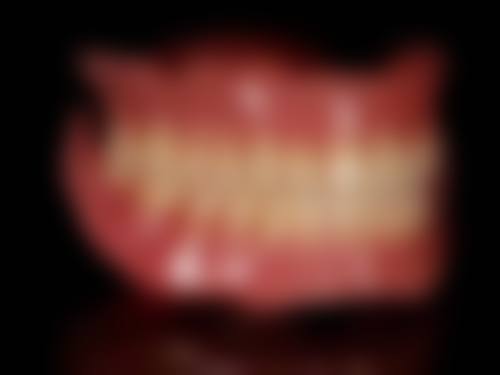 深圳新安麦芽口腔拔牙后多久能用拔牙侧吃东西靠谱吗？