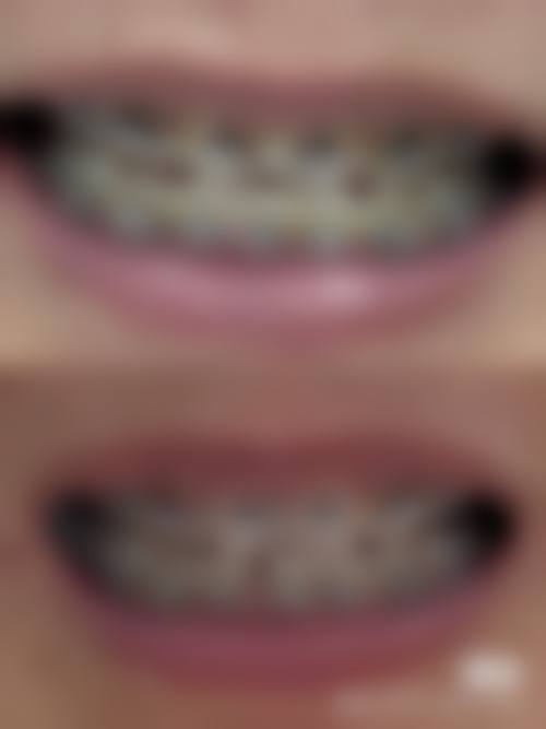 长沙芙蓉马泷口腔门诊部真实实例