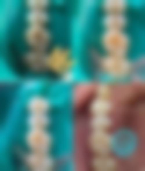 台州温岭柏林口腔价格表