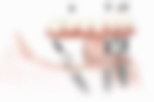 厦门思迈尔口腔门诊部洗牙对全瓷牙有保护吗?