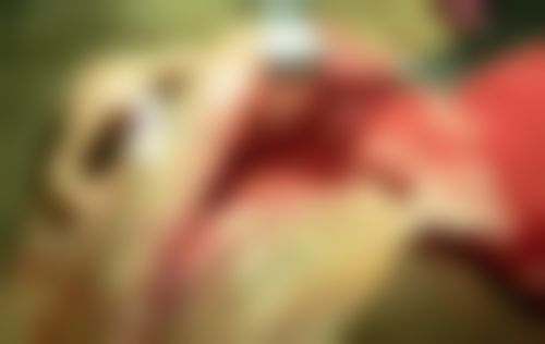 浙江杭州嘉德口腔门诊部价格表大公开