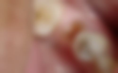 广州德祥大山口腔门诊部价格表