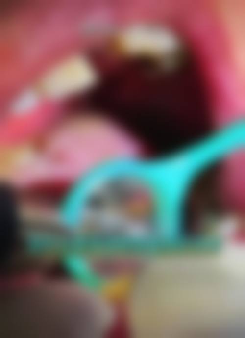 成都高新洁雅口腔诊所真实实例