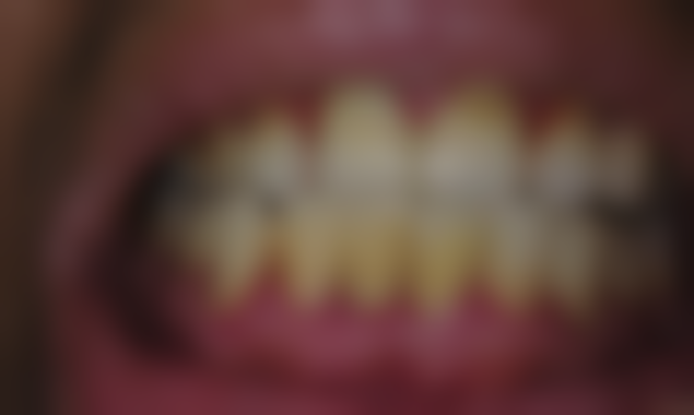 李新医生口碑评价：患者的一致好评