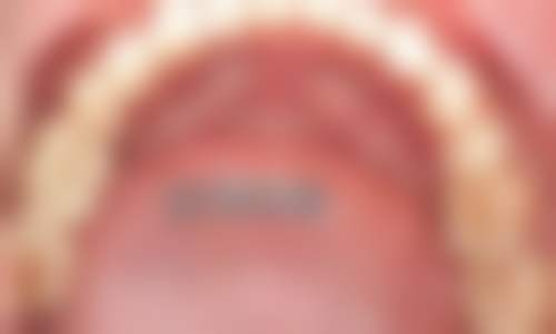 江苏常州柠之檬口腔擅长项目:满足你的多样需求