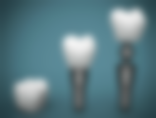 牙神经烂了根管治疗后要注意什么