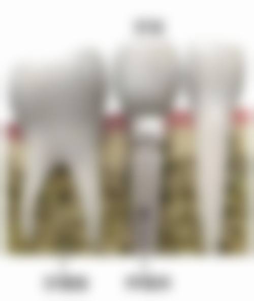 赤峰福汇口腔门诊部价格表