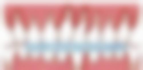 牙齿清洁不到位会导致补牙材料脱落吗