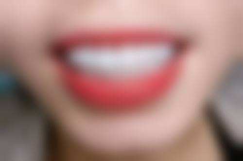 深圳福田伶俐口腔诊所预约挂号方式