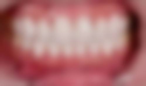 阜阳市第六人民医院口腔科预约挂号方式