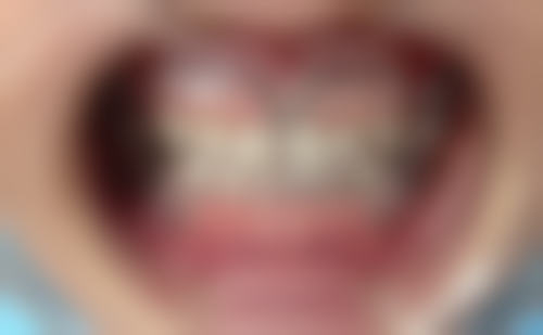 来大姨妈洗牙对身体有哪些潜在影响